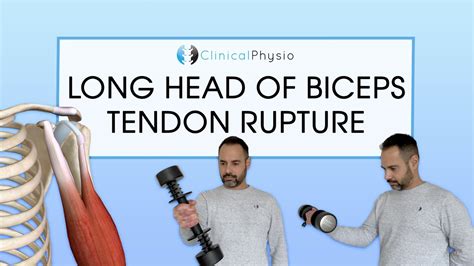 test for long head of biceps tear|imaging for bicep tendon rupture.